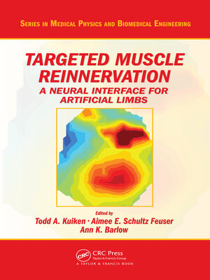 cover image of Targeted Muscle Reinnervation